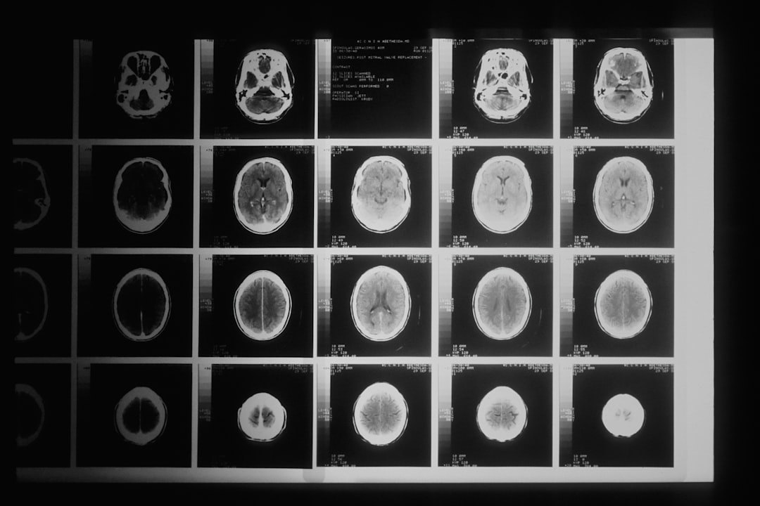 How to Become a Neurosurgeon: A Guide for Teens